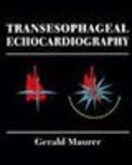 Transesophageal Echocardiography