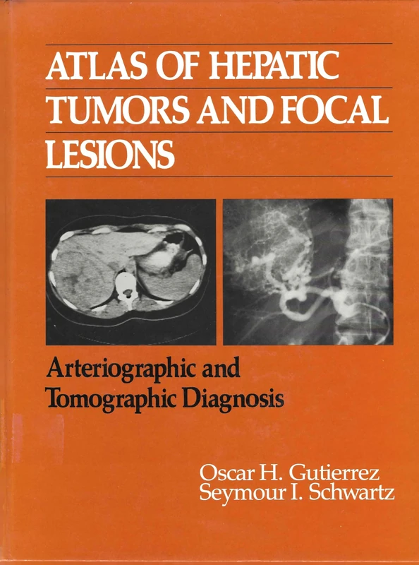 Atlas of Hepatic Tumours and Focal Lesions: Arteriographic and Tomographic Diagnosis