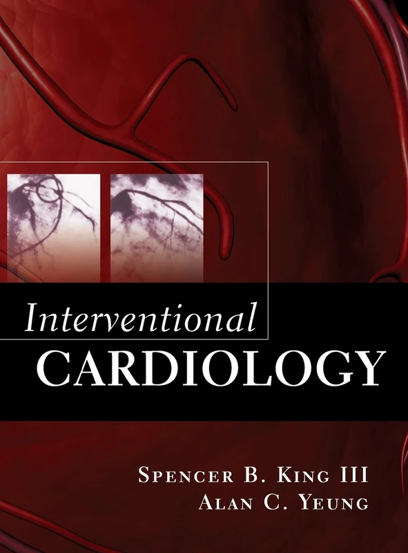 Interventional Cardiology