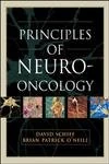 Principles of Neuro-Oncology - Image 1