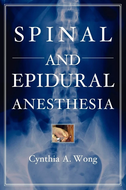 Spinal and Epidural Anesthesia (MEDICAL/DENISTRY)