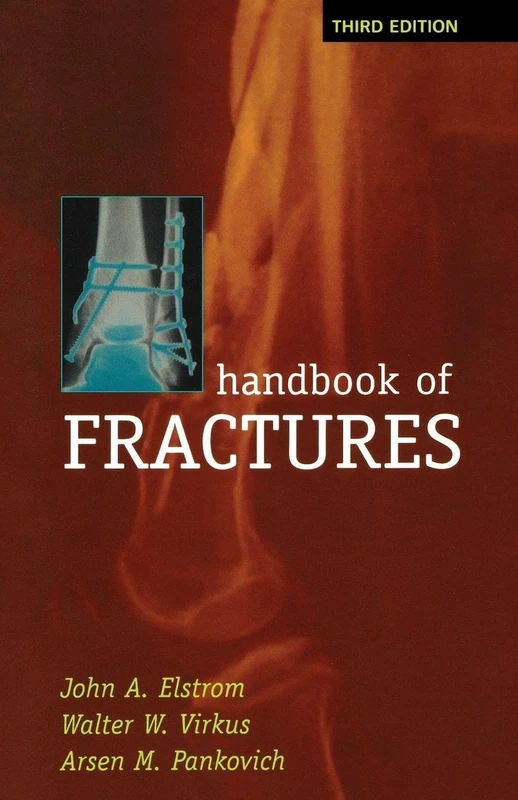 Handbook of Fractures, Third Edition (MEDICAL/DENISTRY)