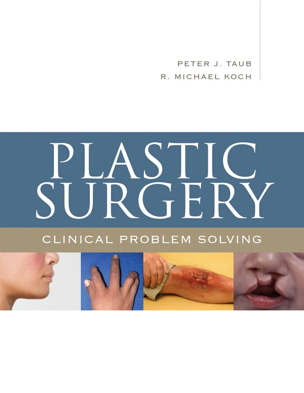 Plastic Surgery: Clinical Problem Solving (INTERNAL MEDICINE)