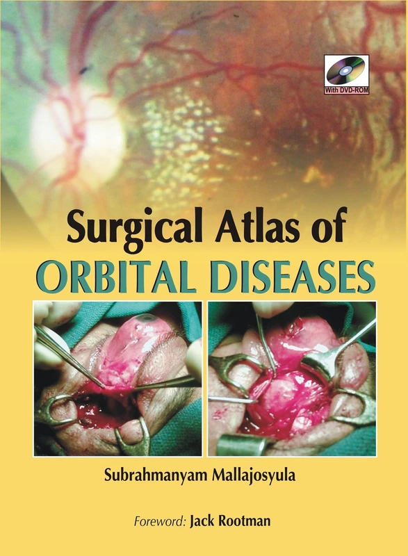 Surgical Atlas of Orbital Diseases