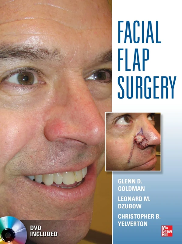 Facial Flaps Surgery (MEDICAL/DENISTRY)