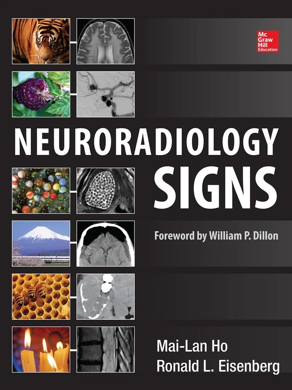 Neuroradiology Signs (RADIOLOGY)