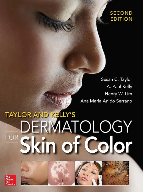 Taylor and Kelly's Dermatology for Skin of Color 2/E (MEDICAL/DENISTRY)