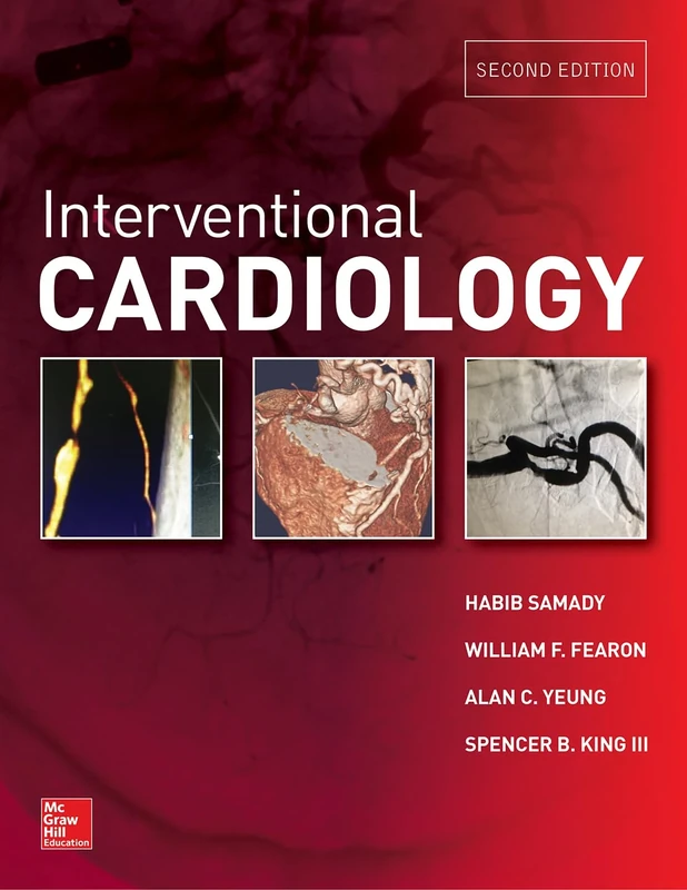 Interventional Cardiology, Second Edition (MEDICAL/DENISTRY)