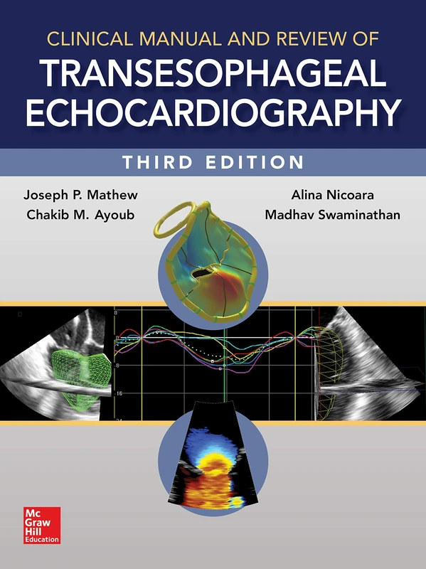Clinical Manual and Review of Transesophageal Echocardiography, 3/e (MEDICAL/DENISTRY)