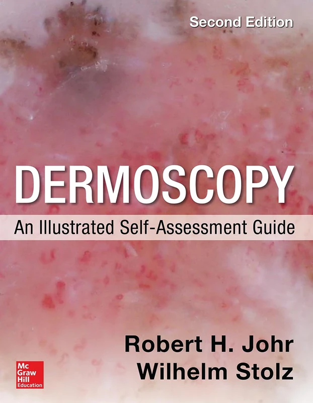 Dermoscopy: An Illustrated Self-Assessment Guide, 2/e (DERMATOLOGY)