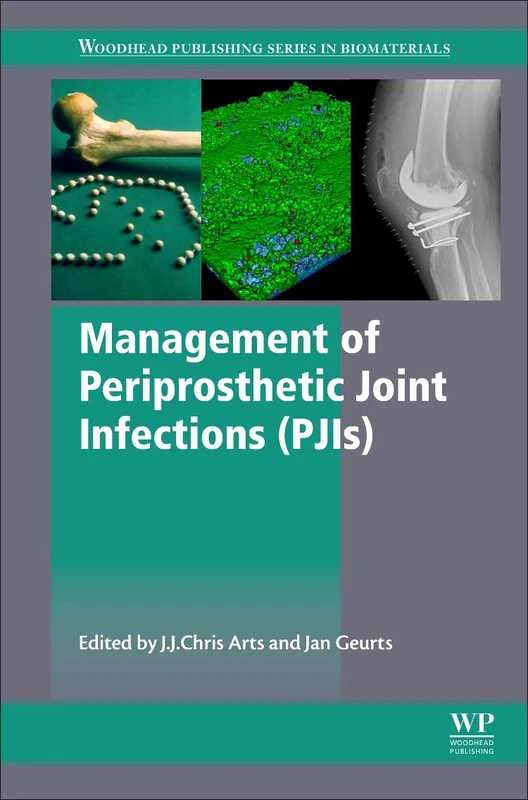 Management of Periprosthetic Joint Infections (PJIs) (Woodhead Publishing Series in Biomaterials)