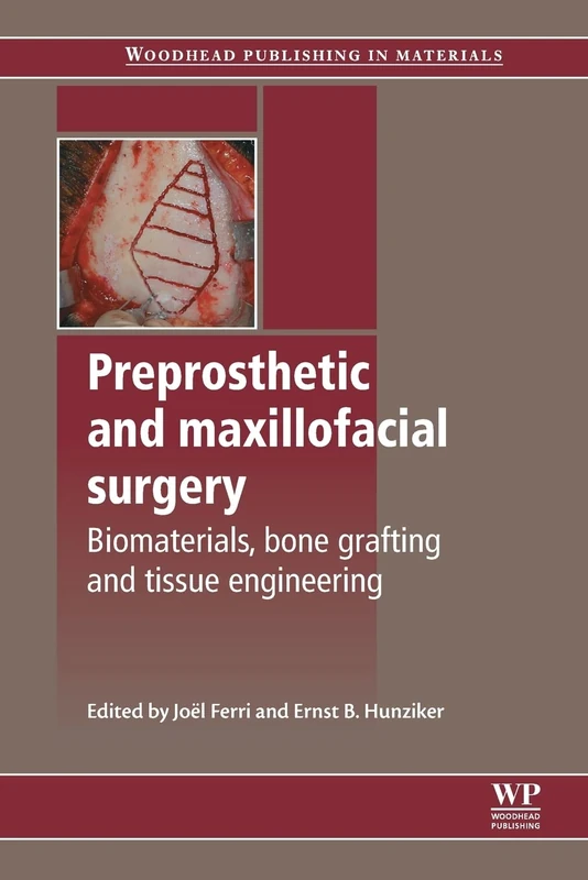 Preprosthetic and Maxillofacial Surgery - Woodhead Publishing