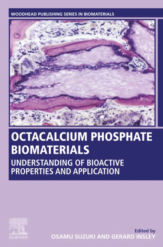 Octacalcium Phosphate Biomaterials: Understanding of Bioactive Properties and Application (Woodhead Publishing Series in Biomaterials)