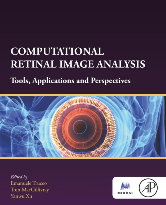 Academic Press Computational Retinal Image Analysis Book