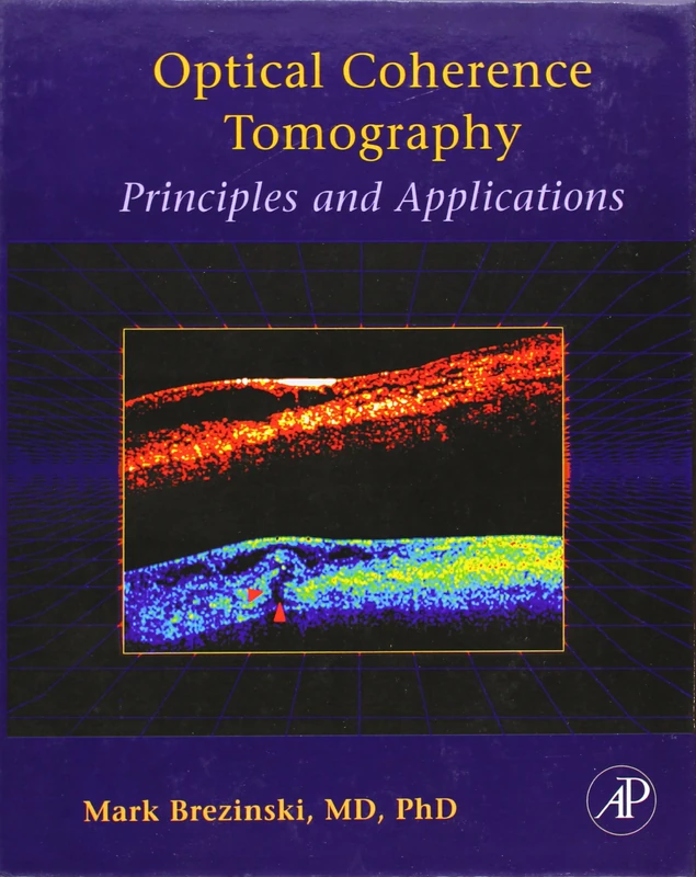 Academic Press: Optical Coherence Tomography Principles and Apps