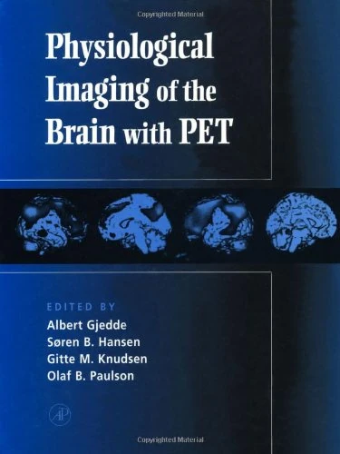 Physiological Imaging of the Brain with PET