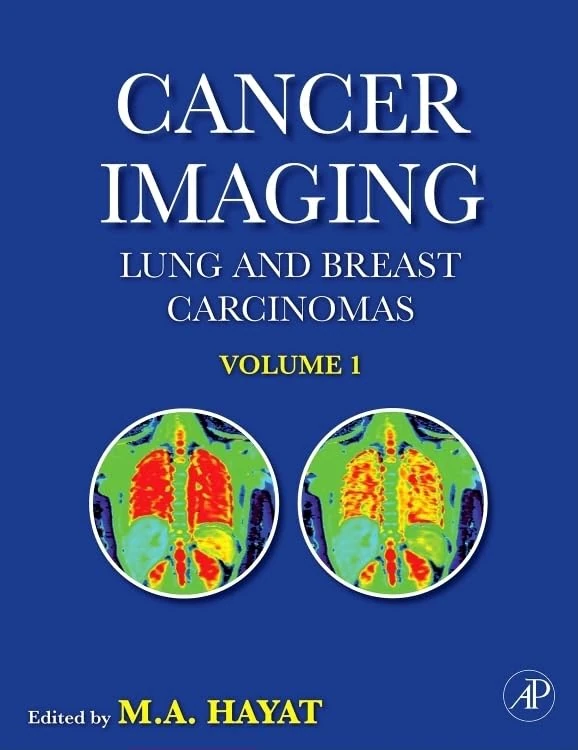 Academic Press - Cancer Imaging: Lung and Breast Carcinomas