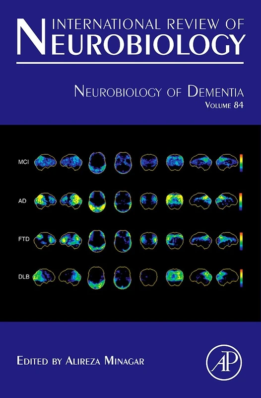 Neurobiology of Dementia (International Review of Neurobiology): Volume 84