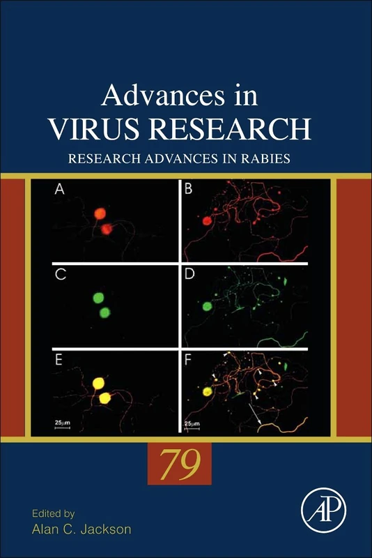 Research Advances in Rabies: 79 (Advances in Virus Research): Volume 79