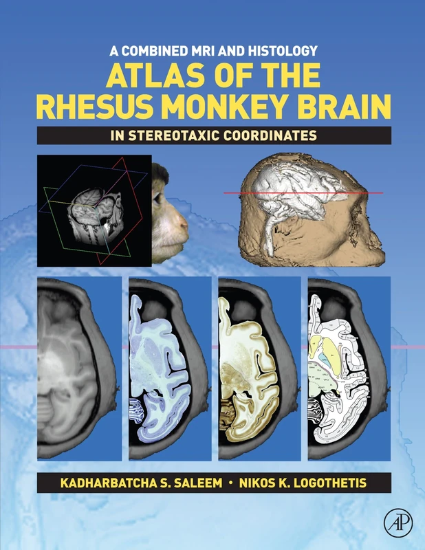 A Combined MRI and Histology Atlas of the Rhesus Monkey Brain: In Stereotaxic Coordinates