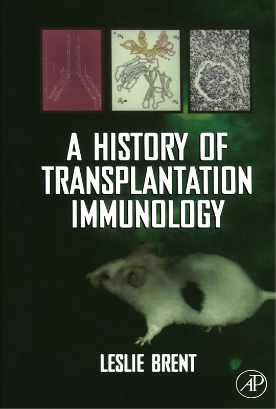 A History of Transplantation Immunology