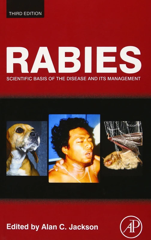 Rabies: Scientific Basis of the Disease and Its Management