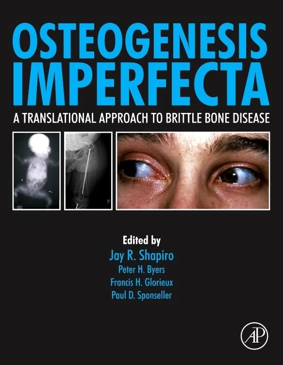 Academic Press - Osteogenesis Imperfecta: Brittle Bone Disease