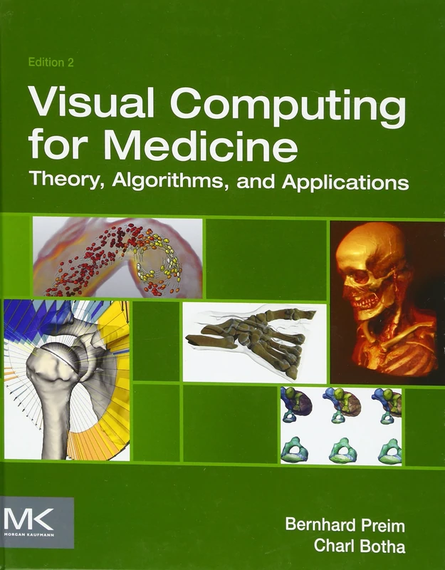 Visual Computing for Medicine: Theory, Algorithms, and Applications (The Morgan Kaufmann Series in Computer Graphics)