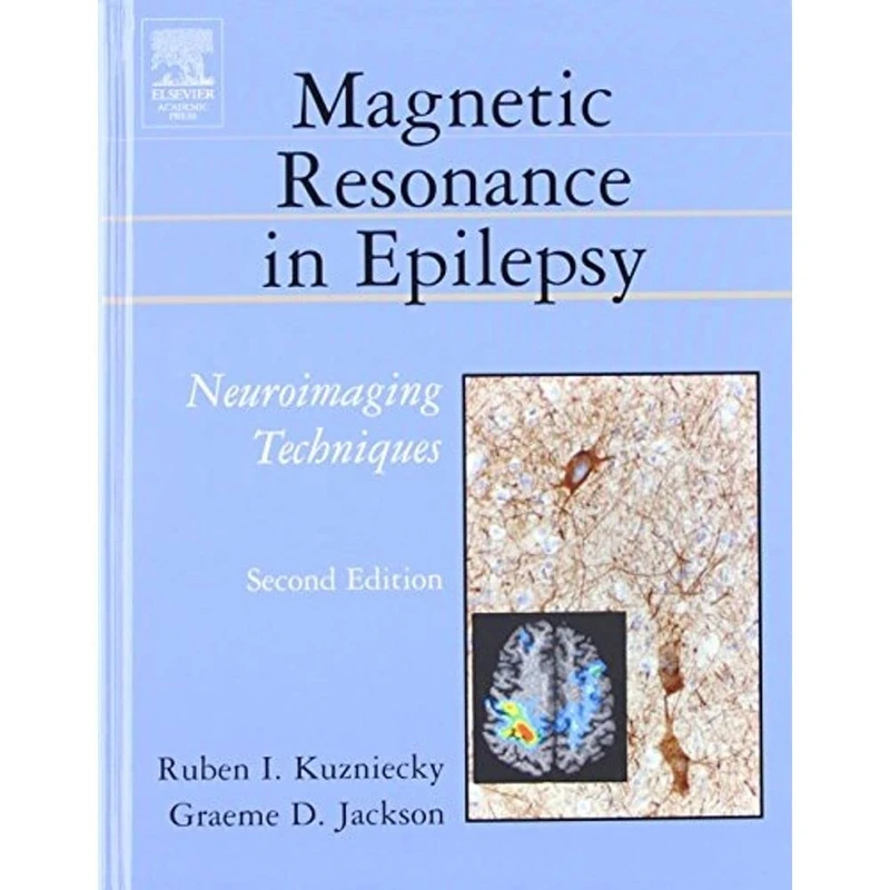 Academic Press Magnetic Resonance in Epilepsy, 2nd Edition