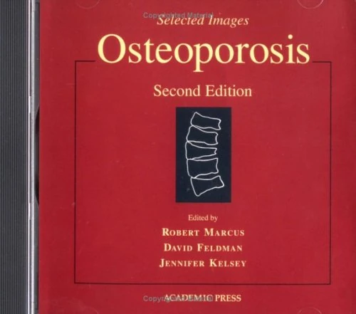 Osteoporosis [CD-ROM]