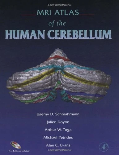 MRI Atlas of the Human Cerebellum