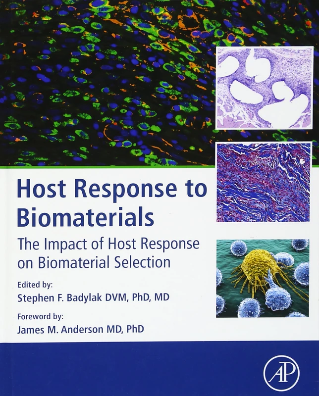 Host Response to Biomaterials: The Impact of Host Response on Biomaterial Selection