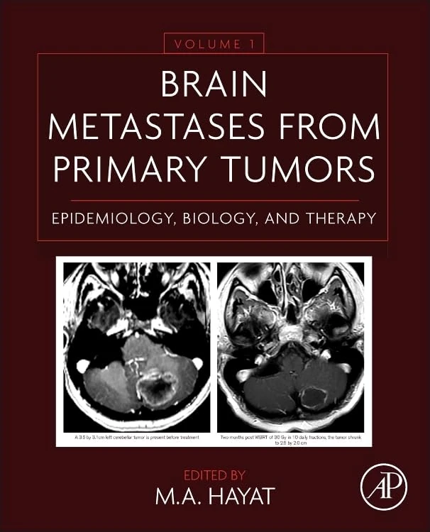 Brain Metastases from Primary Tumors: Epidemiology, Biology, and Therapy: 1