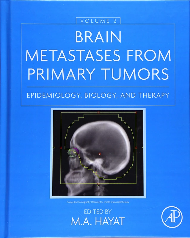 Brain Metastases from Primary Tumors: Epidemiology, Biology, and Therapy: 2