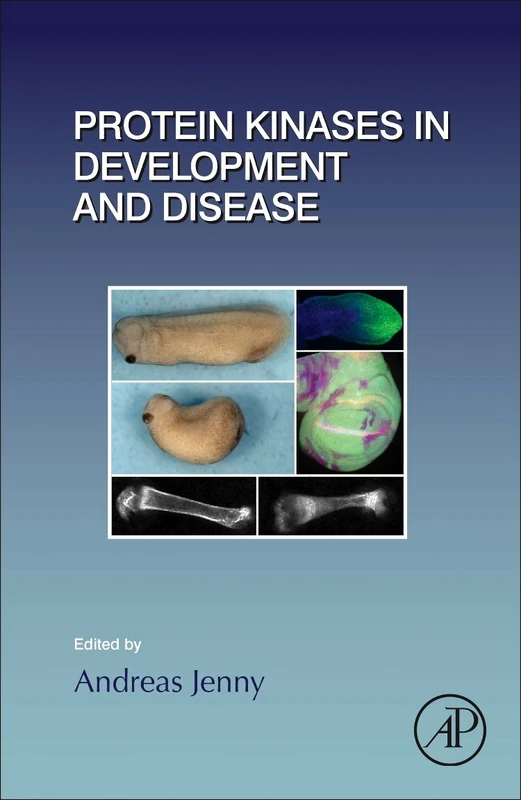 Protein Kinases in Development and Disease: Volume 123 (Current Topics in Developmental Biology, Volume 123)