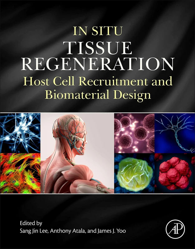 In Situ Tissue Regeneration: Host Cell Recruitment and Biomaterial Design
