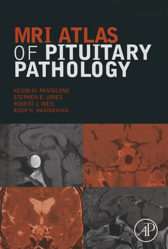 MRI Atlas of Pituitary Pathology