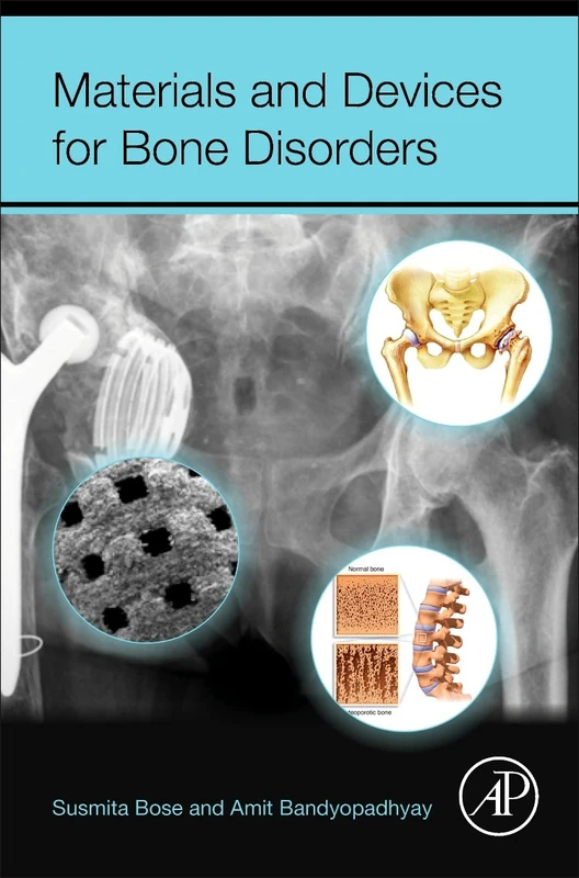 Materials and Devices for Bone Disorders - Image 1