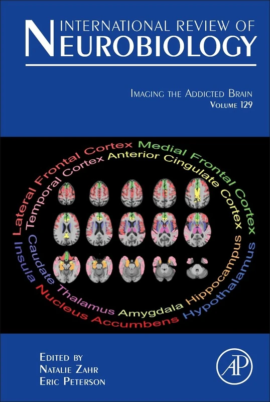 Imaging the Addicted Brain: Volume 129 (International Review of Neurobiology, Volume 129)