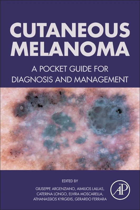 Cutaneous Melanoma: A Pocket Guide For Diagnosis And Management
