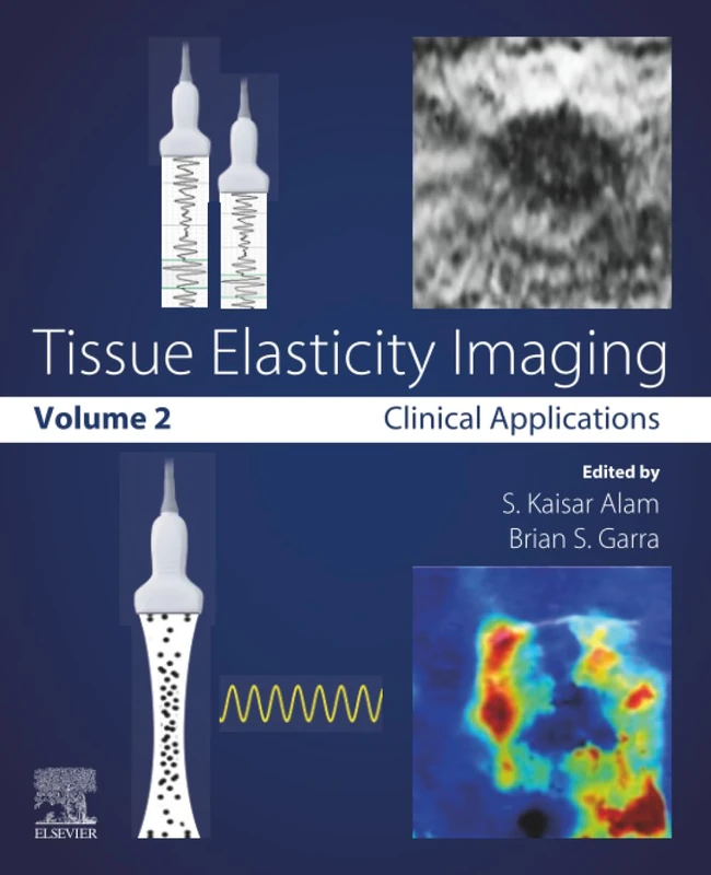 Tissue Elasticity Imaging: Volume 2: Clinical Applications