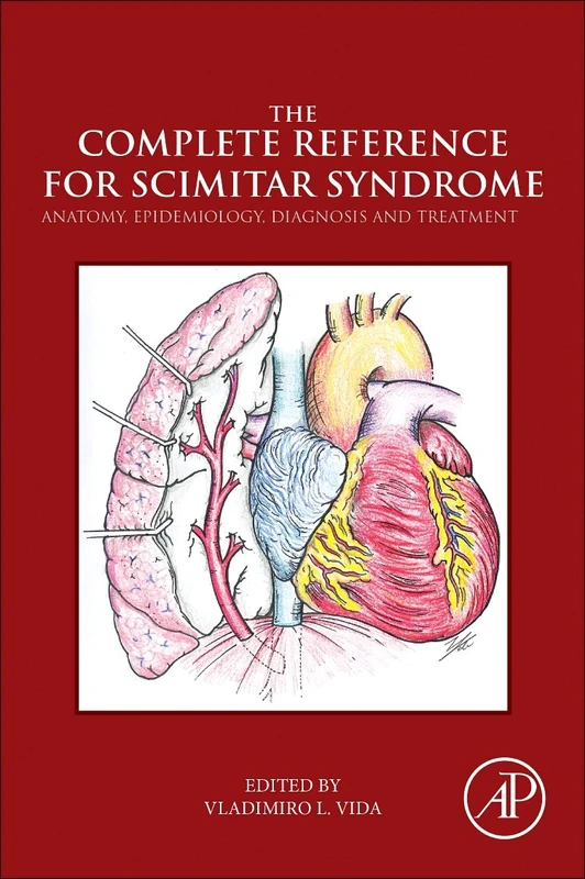 The Complete Reference for Scimitar Syndrome: Anatomy, Epidemiology, Diagnosis and Treatment - Image 1
