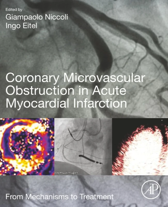 Coronary Microvascular Obstruction in Acute Myocardial Infarction: From Mechanisms to Treatment