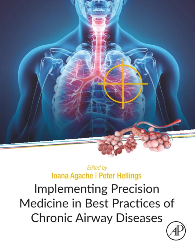 Implementing Precision Medicine in Best Practices of Chronic Airway Diseases
