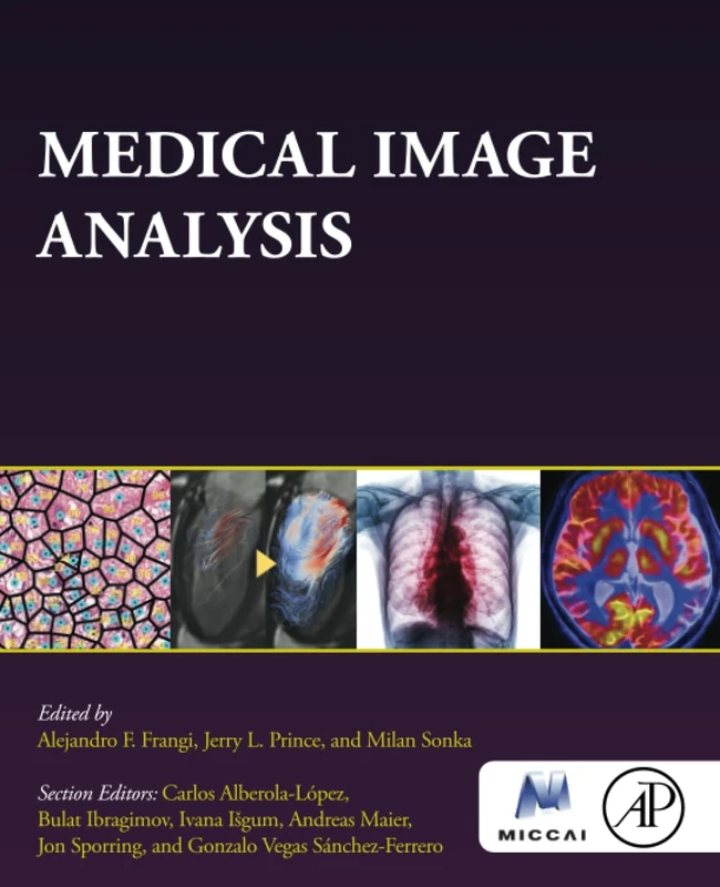 Medical Image Analysis (The MICCAI Society book Series)