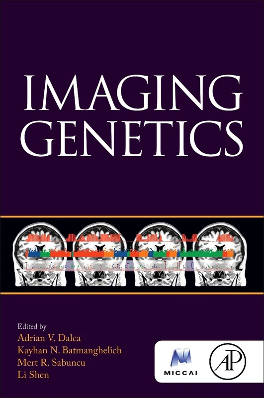 Imaging Genetics (The MICCAI Society book Series)