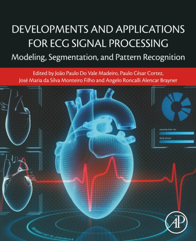 Developments and Applications for ECG Signal Processing: Modeling, Segmentation, and Pattern Recognition