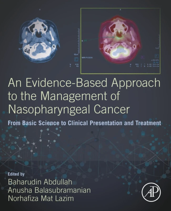 Academic Press Nasopharyngeal Cancer Management Textbook - Image 1