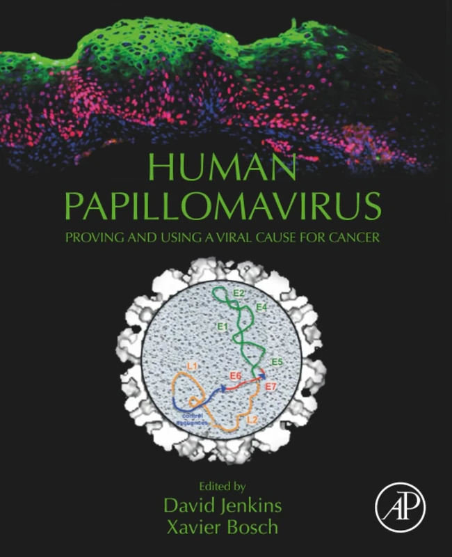 Human Papillomavirus: Proving and Using a Viral Cause for Cancer