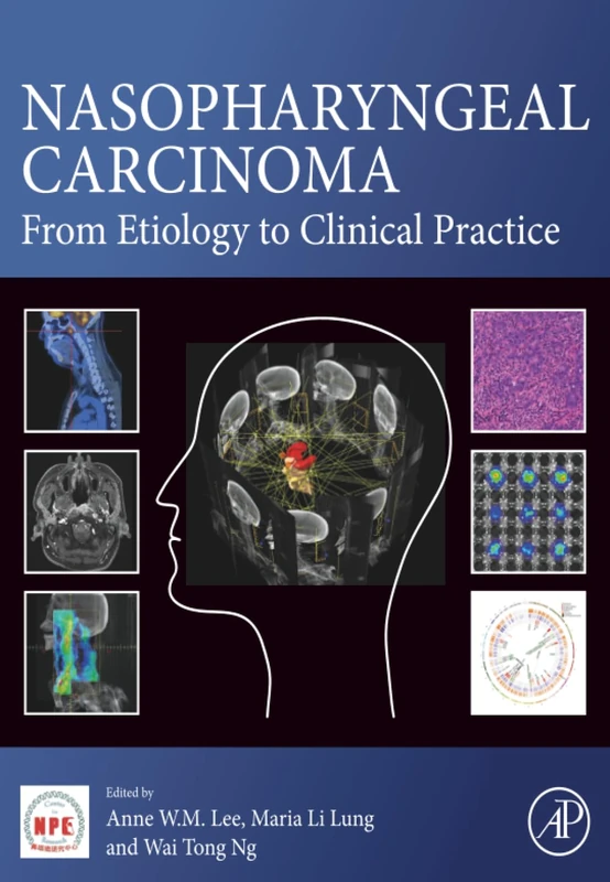 Nasopharyngeal Carcinoma: From Etiology to Clinical Practice